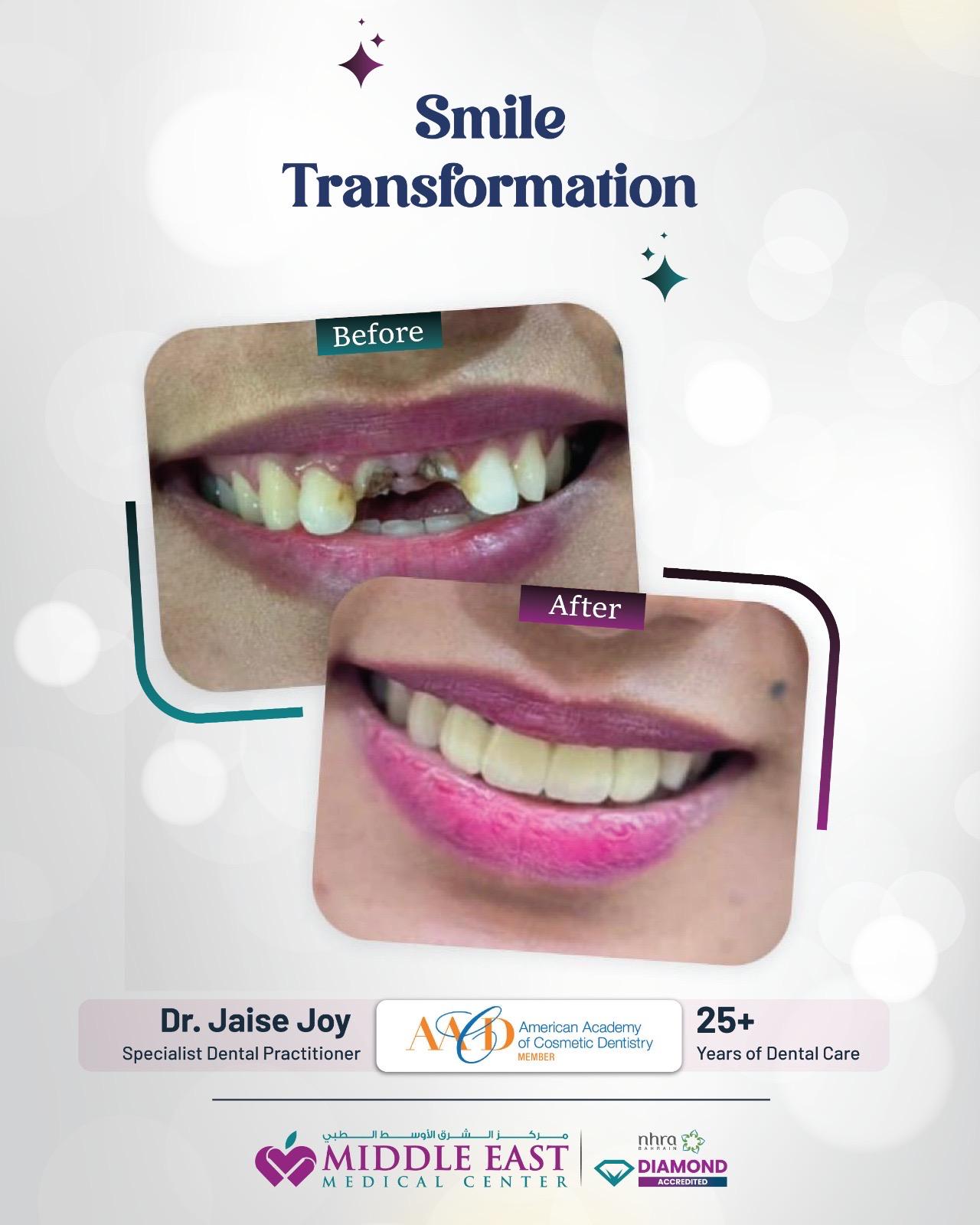 Cosmetic dentistry result